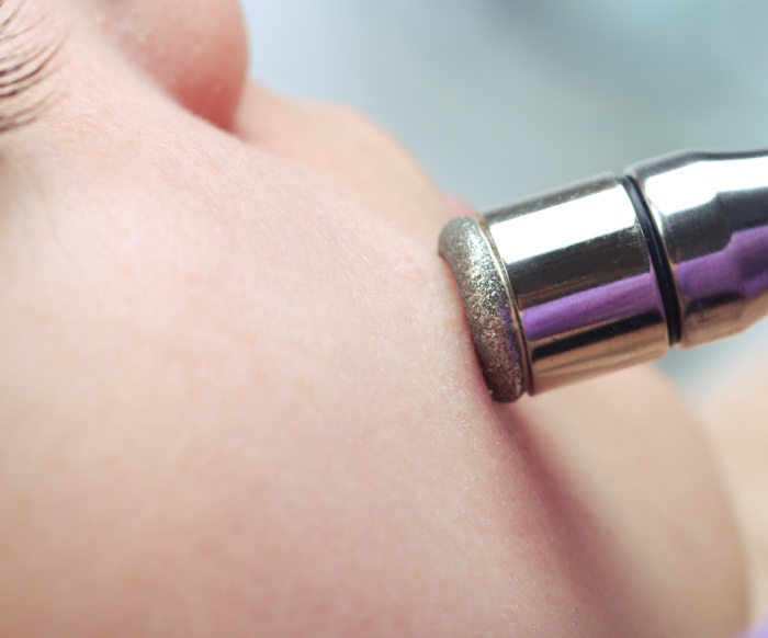 Microdermabrasion - apparative Kosmetik, Gerät in Großaufnahme an der Wange - beautyscout